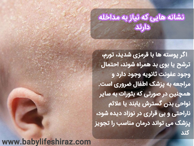 نشانه هایی که نیاز به مداخله دارند